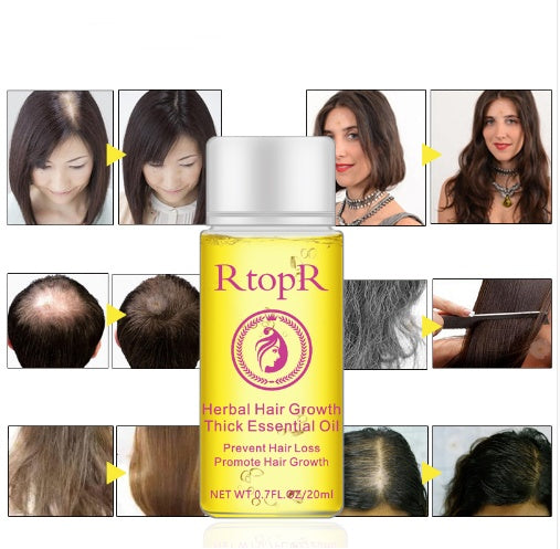 Fast Powerful Hair Growth Products Essential Oil Liquid Treatment Preventing Hair Loss Hair Care 20ml Fast Powerful Hair Growth Products Essential Oil Liquid Treatment Preventing Hair Loss Hair Care 20ml
